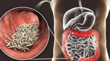 Entre el 50 y 80 % de niños del Gran La Plata y el conurbano se ven afectados por parásitos intestinales