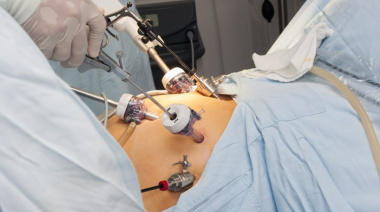 En 5 días realizarán 1000 cirugías laparoscópicas de vesícula en 38 hospitales públicos de la Provincia