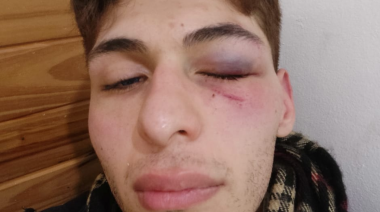 Vecinos agredieron con un ataque homofóbico a un joven con asperger en La Plata