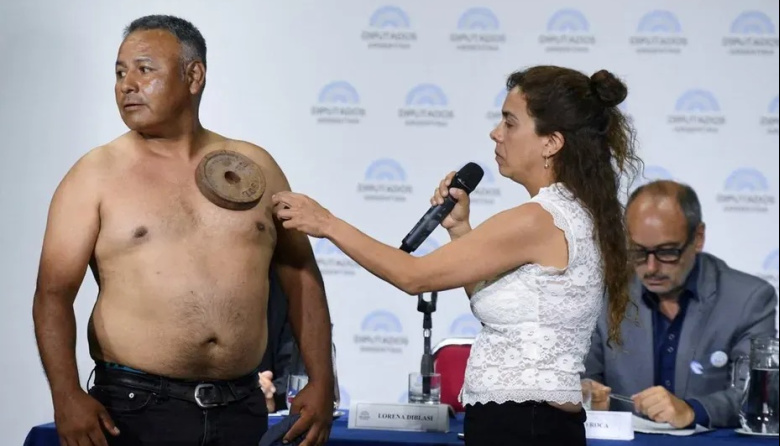 Tras el show del "Hombre Imán" en Diputados, arrecian las críticas contra Martín Menem y la diputada antivacunas