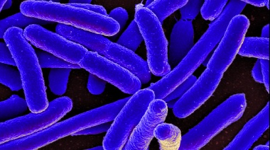 Investigadores argentinos desarrollaron una vacuna capaz de reducir la colonización de Escherichia coli en bovinos