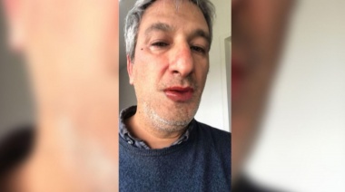 Un periodista de La Plata fue atacado por dos trabajadores de la empresa concesionaria de las grúas de acarreo