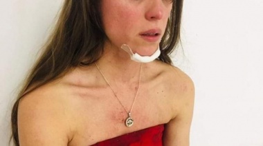 Tres jóvenes denunciaron haber sido golpeados por los guardias de un bar de La Plata