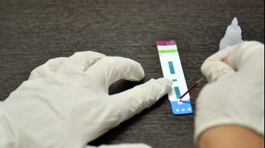 En el Día Mundial de Lucha contra el SIDA dispusieron puntos de testeos de HIV en distintos puntos de La Plata