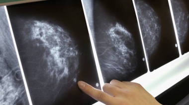 Lograron "buenos resultados" en ensayos de laboratorios para el tratamiento de tumores ginecológicos