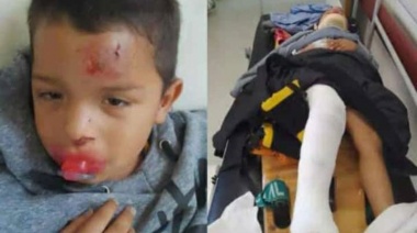 Denuncian que un automovilista atropelló a un nene de 4 años en La Plata y escapó
