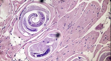 Registraron un nuevo brote de triquinosis en la provincia de Buenos Aires