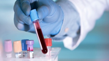 Estudios revelan un análisis de sangre que puede detectar el cáncer hasta siete años antes