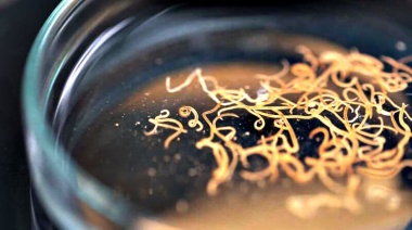 Investigadores advierten que la parasitosis es un problema acuciante en los barrios populares de La Plata