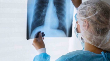 En 5 años los casos de tuberculosis en Argentina aumentaron un 65%