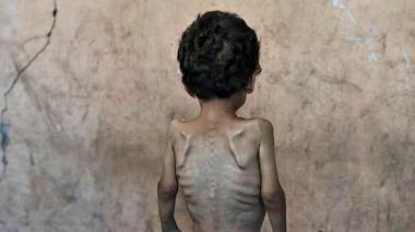 La población palestina de Gaza se muere de inanición y en Argentina nadie habla del genocidio israelí