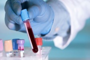 Estudios revelan un análisis de sangre que puede detectar el cáncer hasta siete años antes